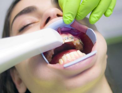 Diş Dolgusu Kaç Yılda Bir Değiştirilmeli